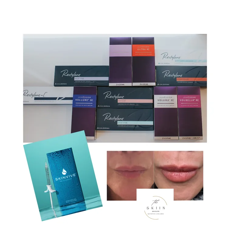 Before and after of a hyaluronic acid lip filler treatment with Restylane and Juvéderm