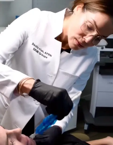 Desha Irion, APRN, performing a microneedling treatment on a patient