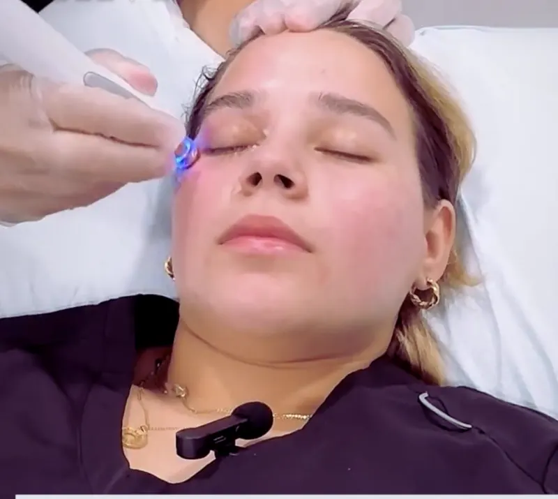 Energy-based treatment being performed near a patient's eye area